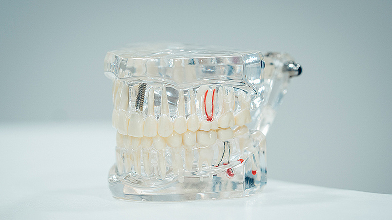 Endodontie